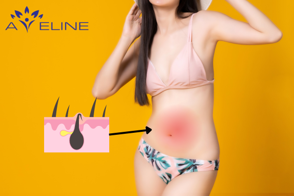 is-it-harmful-for-women-to-shave-belly-hair